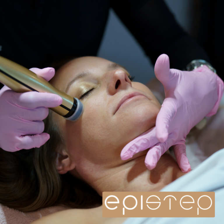 EpiFusion Facial with Epistep: The Science Behind Hyaluronic Pins and Ideal Candidates